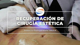 Recuperación de Cirugía Estética: Protocolo Postoperatorio Vescica