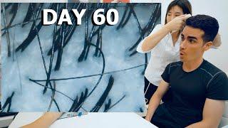 ASMR: CHINESE TREATMENT for GRAY HAIR and SCALP MASSAGE for 60 DAYS!