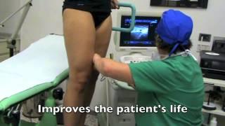 CHIVA method and Varicose Veins - Trailer