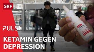 Ketamin: Können Drogen gegen Depression helfen? | Puls | SRF Wissen