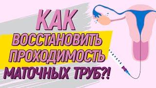 Как ВОССТАНОВИТЬ проходимость маточных труб? 