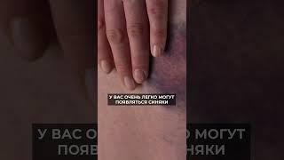 Как ИЗБЕЖАТЬ дефицита ВИТАМИНА С? #витамины #витаминc #витаминц #здоровье