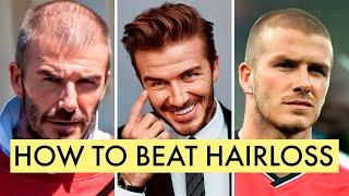 Hair Loss: How To Stop It For Real (No BS Guide)