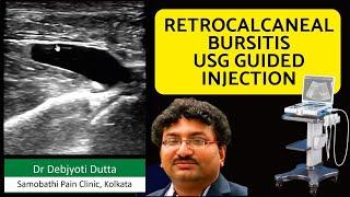 Retrocalcaneal Bursitis Aspiration and Corticosteroid Injection | Dr Debjyoti Dutta