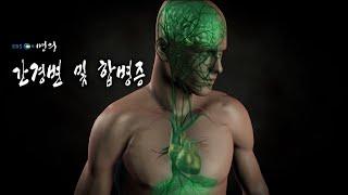 [명의 의학백과] 간경변 및 합병증