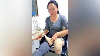 Amputee Girl Getting Ready to Walk with New Prosthetics | Amputacao