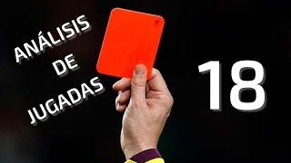 Análisis de jugadas #18 - Regla 12 Faltas y conducta incorrecta