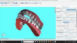 BlueSkyPlan Ortho: Automated Intrusion/Extrusion Alignment