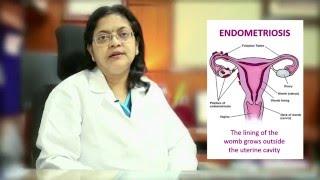 #Endometriosis - Health Talk by Dr Rooma Sinha, Consultant Gynecologist, Apollo Hospitals, Hyderabad