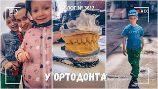 Два ортодонта  за день| Начинаем эксперимент | Отметили завершение  -  ВЛОГ №3617 - 31.05.25