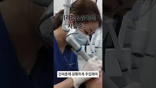 쥬베룩의 좋은 성분을 미라젯으로 시술 받는다면?  feat.리얼 시술영상