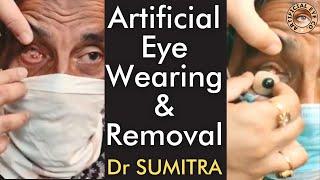 Quick Artificial eye wearing and removal - old aged man | Dr Sumitra