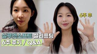 팔자/입가주름 뿌신 실루엣플리프팅(실리프팅) 6주 후기ㅣQ&A까지!!