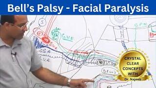 Bell’s Palsy | Facial Paralysis | Neuroscience