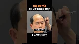 10년 동안 쓰던 가발 벗으니 홀가분하네요