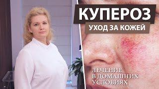 Лечение купероза на лице в домашних условиях. Купероз - что это?