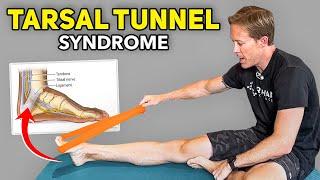 5 Home Exercises for Tarsal Tunnel Syndrome