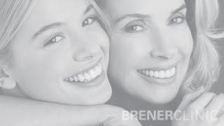 Brener Clinic - Bone Grafting