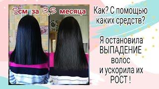 Как я ОСТАНОВИЛА ВЫПАДЕНИЕ волос, укрепила и УСКОРИЛА их РОСТ⁉️