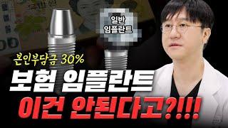 65세 건강보험 임플란트 vs 일반 임플란트 | 어버트먼트와 크라운 비교까지