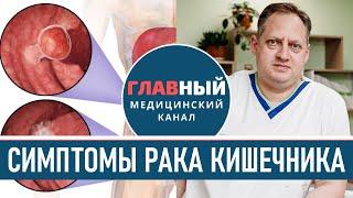 Симптомы РАКА кишечника. Колоректальный рак прямой и толстой кишки. Как понять что у тебя рак