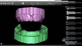 Denture Module