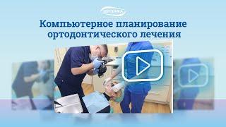 Компьютерное планирование ортодонтического лечения
