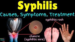 Syphilis: Causes, Signs, Symptoms, Diagnosis, Treatment and Prevention