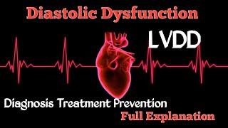 Diastolic Dysfunction | LVDD | Heart Failure | Echocardiography | Hindi | ECG | Science Plus