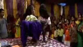 Spider girls -  ( Indian Conjoined twins who married to one man )