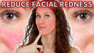  5 Reasons Your Face Is Always Red (Rosacea to Dermatographia & Everything In-between!)