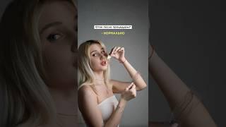 О реабилитации после увеличения губ ️ смотри комментарии #косметологмосква #увеличениегубмосква