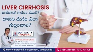 Symptoms of Liver Cirrhosis | How do we diagnose Liver Cirrhosis ? | Sentini City Hospital #sentini