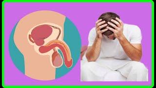 ERECTILE DYSFUNCTION HAMI YARIDA KACSIGA SARIRITA RAGA WAJAHDE GALMADA WAXA KEYNA DR. MAHAMED LIBAN