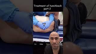 Chiropractic adjustment of severe hunchback! #chiropractor #hunchback #viral #fyp #parati #trending