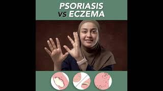 Psoarisis vs Eczema - Dr alina hasni