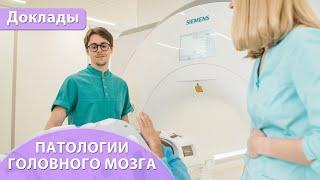 Работа радиолога в неврологическом/нейрохирургическом отделении. Валерий Суховей