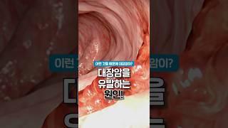 대장암을 유발 하는 최악의 음식! 이걸 당장 끊으세요#대장암#대장암유발음식