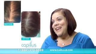 Capillus Laser Hair Therapy - Isabel