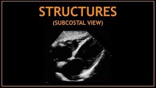 Cardiac STRUCTURES! Subcostal views, Echocardiography.