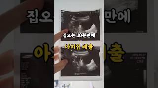 #시험관 #시험관브이로그 #시험관시술 #계류유산