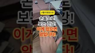 손톱으로 보는 건강! 이게 있으면 암일수 있습니다! #건강 #건강정보