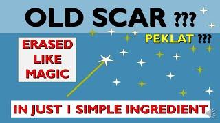 best method of old scar (life hack)