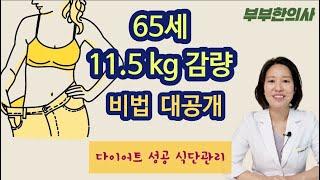 83. 65세 11.5kg 다이어트 성공 식단관리 대공개 | 한의학박사, 서울김, 김선민원장 ㅣ ft 부부한의사