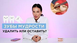 Зубы мудрости: зачем их удалять?