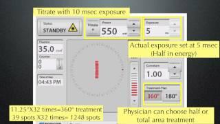 9798 PSLT ophthalmology times video