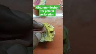 obturator design for palatal perforation #dentistrecords