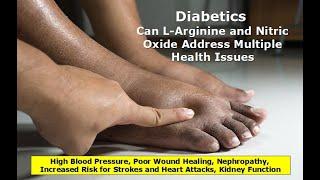 Diabetics Can L Arginine and Nitric Oxide Address Multiple Health Issues