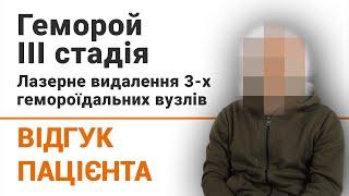 Геморой 3 стадія. Лазерне видалення гемороїдальних вузлів - відгук пацієнта клініки Добрий Прогноз