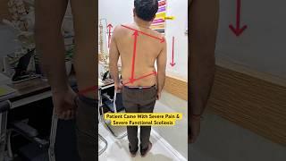 Severe sciatica with functional scoliosis case treatment byDrRavi #scoliosis #chiropractic #sciatica